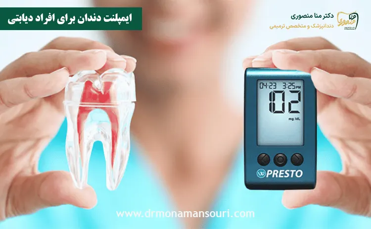 ایمپلنت دندان برای افراد دیابتی