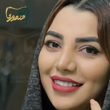 لمینت-سرامیکی-دندان