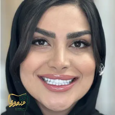 کامپوزیت-ونیر