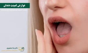 عوارض لمینت دندان