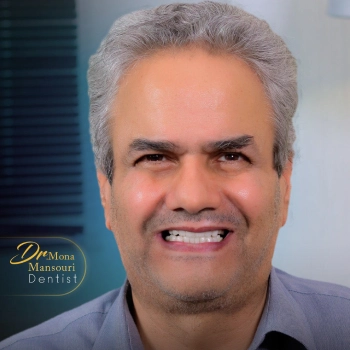 عکس لمینت دندان