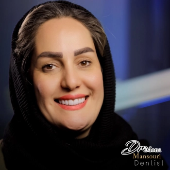 عکس قبل و بعد لمینت دندان