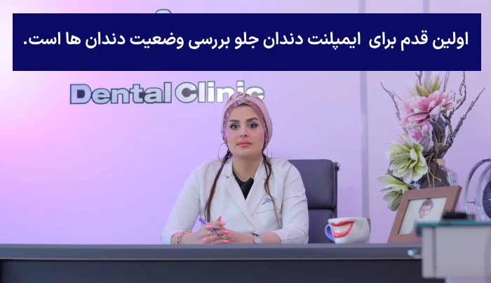 مشاوره ایمپلنت دندان جلو