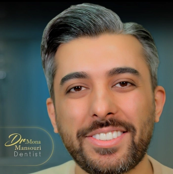 نمونه کار لمینت