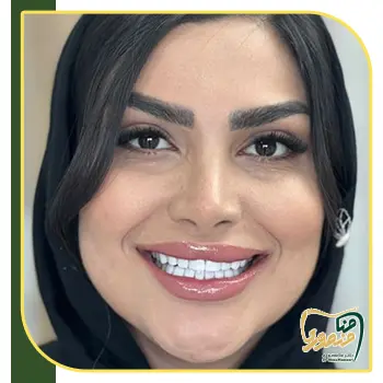 نمونه کامپوزیت