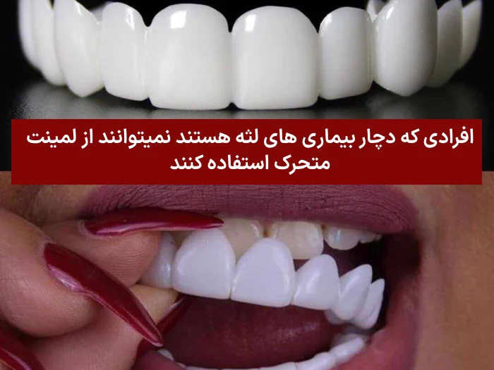 کاندیدای نا مناسب لمینت متحرک دندان