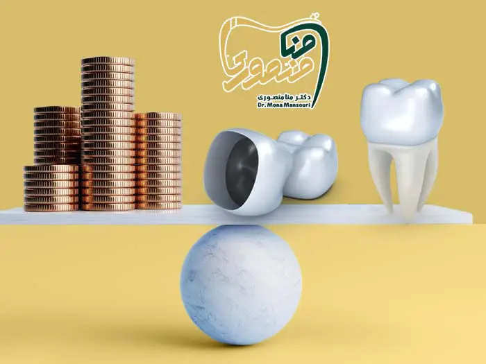 قیمت روکش دندان