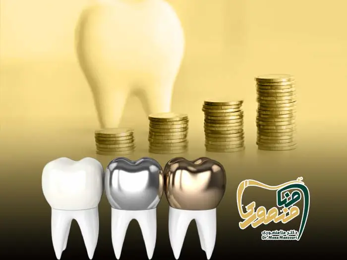 هزینه روکش دندان