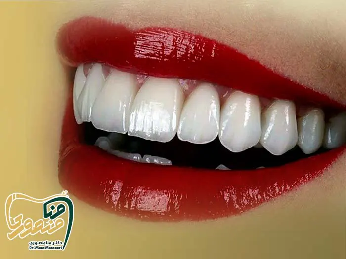 لمینت لبه شیشه ای
