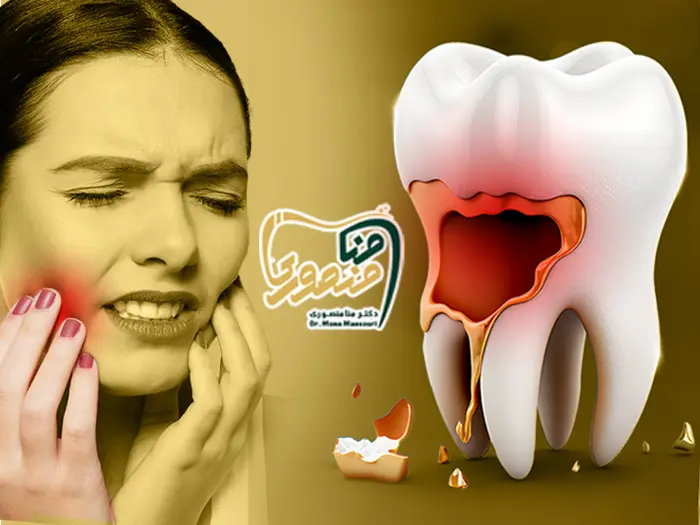 قاتل دندان درد