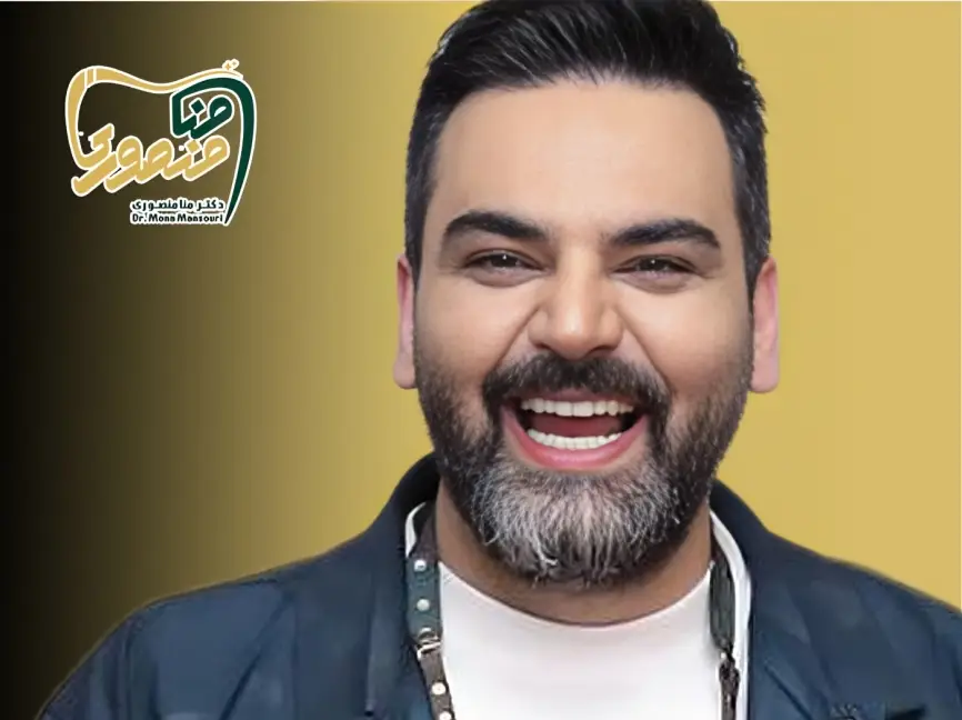 لمینت دندان بازیگران مرد ایرانی