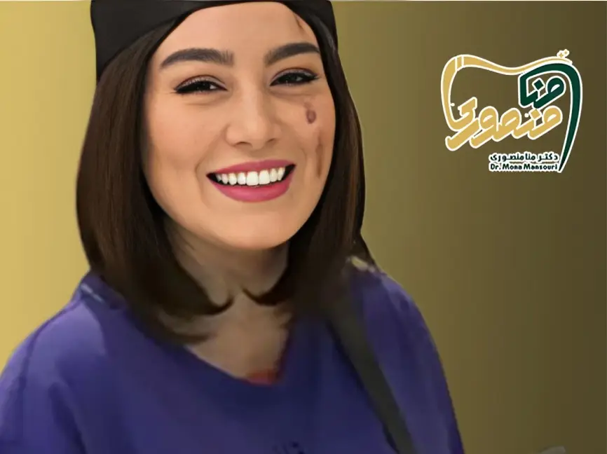 لمینت دندان سحر قریشی