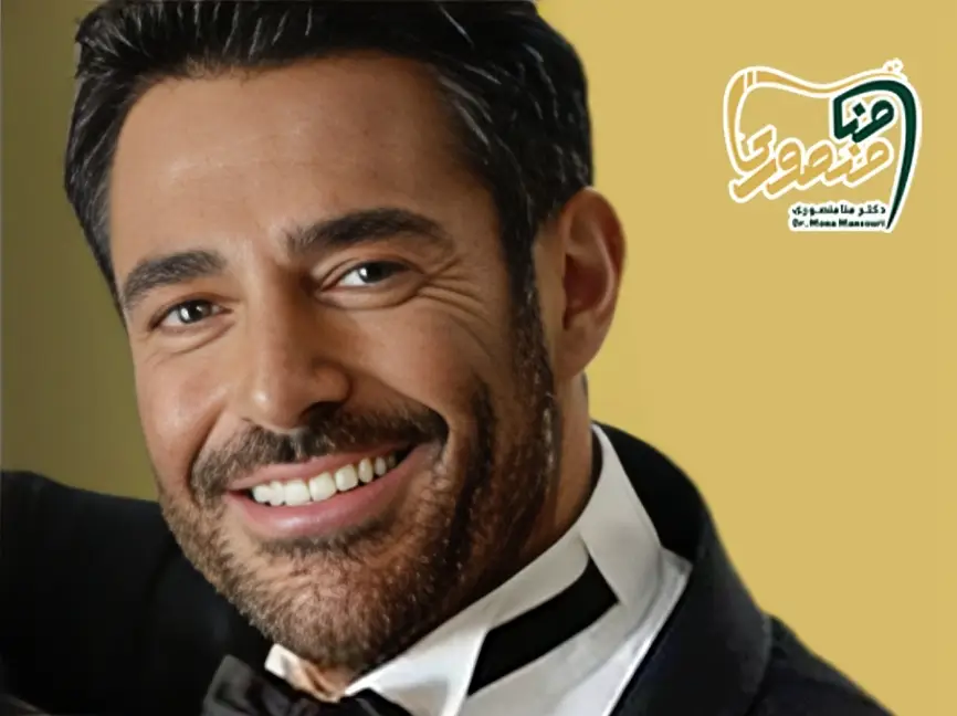 لمینت دندان محمدرضا گلزار