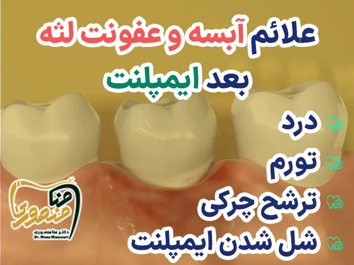 عفونت لثه بعد از ایمپلنت