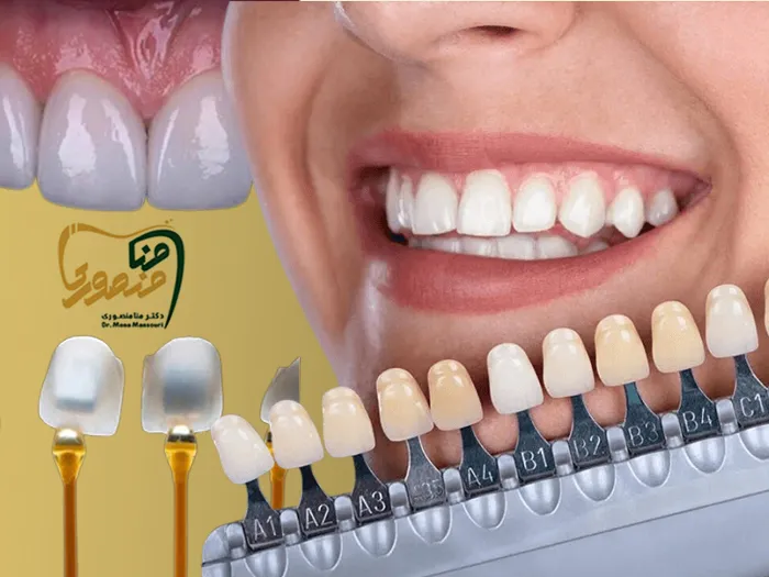 رنگ لمینت