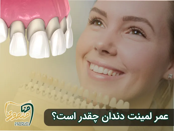 عمر لمینت دندان