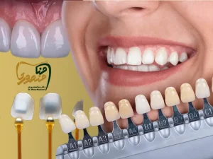 رنگ لمینت