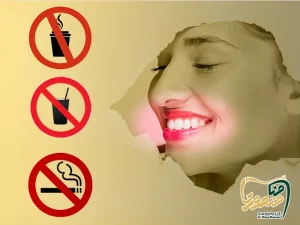 اقدامات بعد کامپوزیت دندان