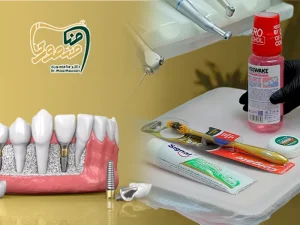 مراقبت های بعد از ایمپلنت دندان
