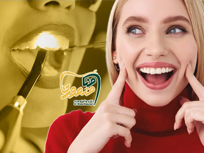 سفید کردن دندان با جرمگیری