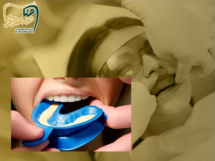فلورایدتراپی کودک و بزرگسال