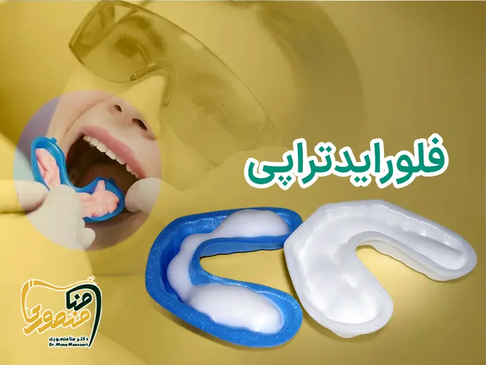 فلورایدتراپی
