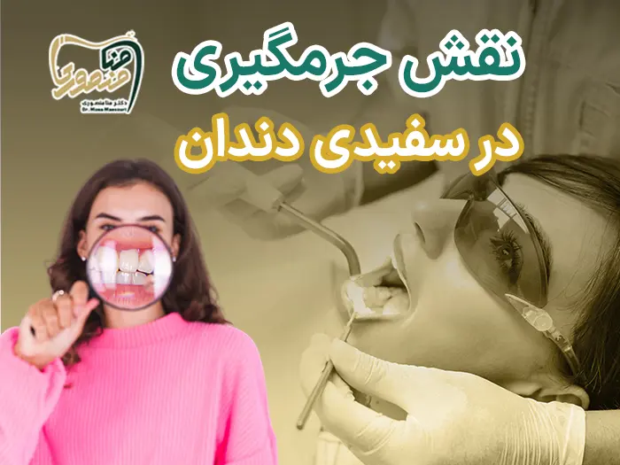 نقش جرمگیری در سفیدی دندان