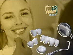 افراد مناسب لمینت