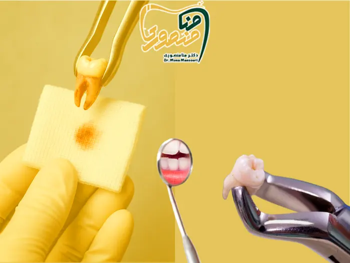 مدت زمان گاز استریل