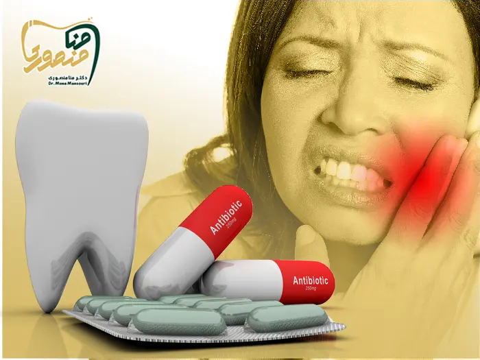 چرک خشک کن برای عفونت دندان
