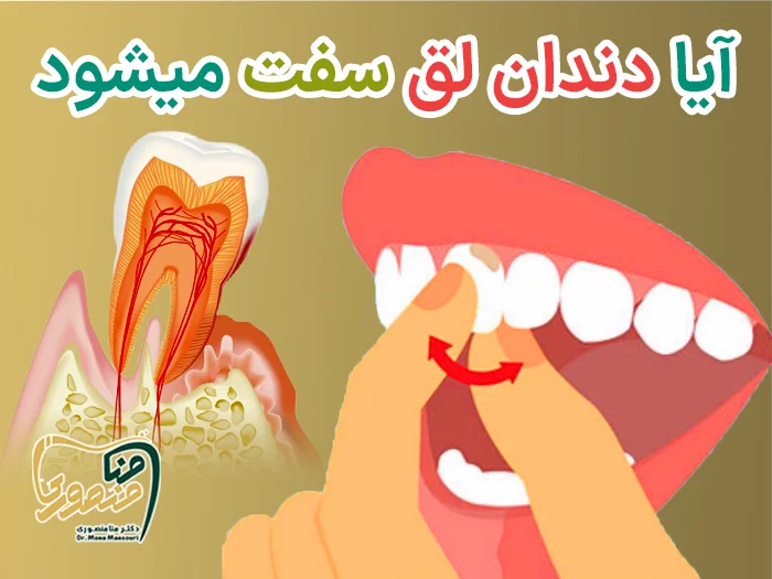 آیا دندان لق سفت میشود