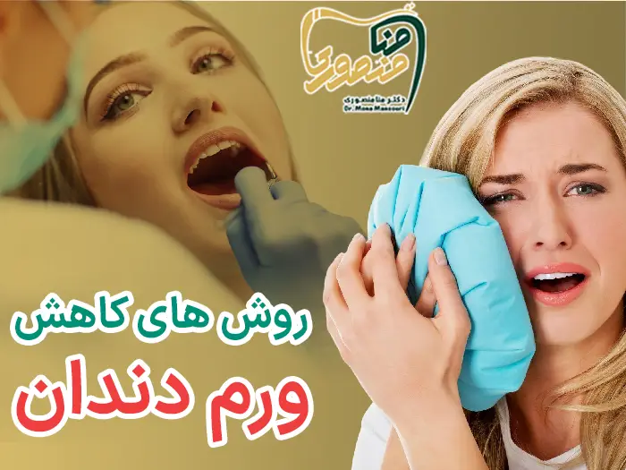 روش های کاهش ورم دندان