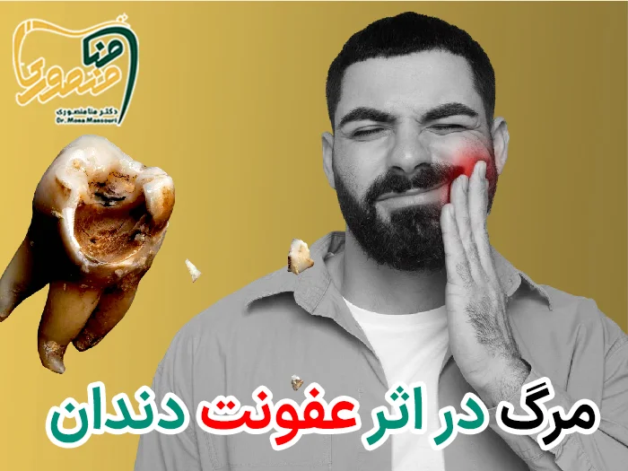 مردن در اثر عفونت دندان