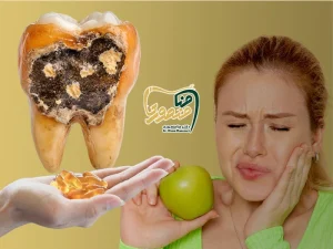 ویتامین و پوسیدگی دندان