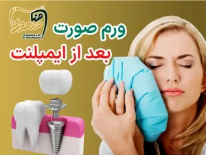 ورم صورت بعد از ایمپلنت