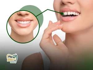 کامپوزیت دندان فاصله دار